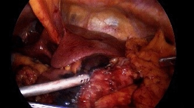 graphic file with name 464_2023_10072_Figek_HTML.jpg