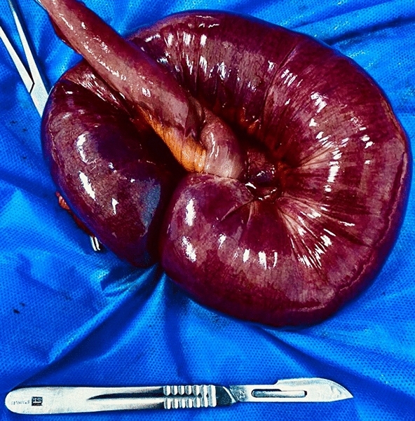 graphic file with name 464_2023_10072_Figq_HTML.jpg