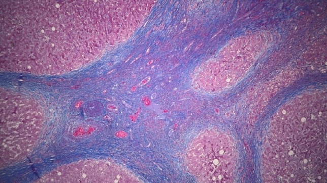 graphic file with name 464_2023_10072_Figeu_HTML.jpg