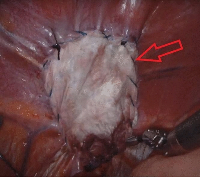 graphic file with name 464_2023_10072_Figgz_HTML.jpg