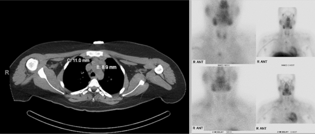 graphic file with name 464_2023_10072_Figft_HTML.jpg