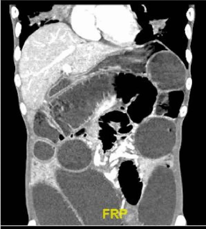 graphic file with name 464_2023_10072_Figfc_HTML.jpg