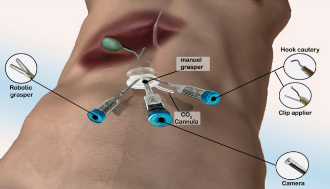 graphic file with name 464_2023_10072_Figbn_HTML.jpg