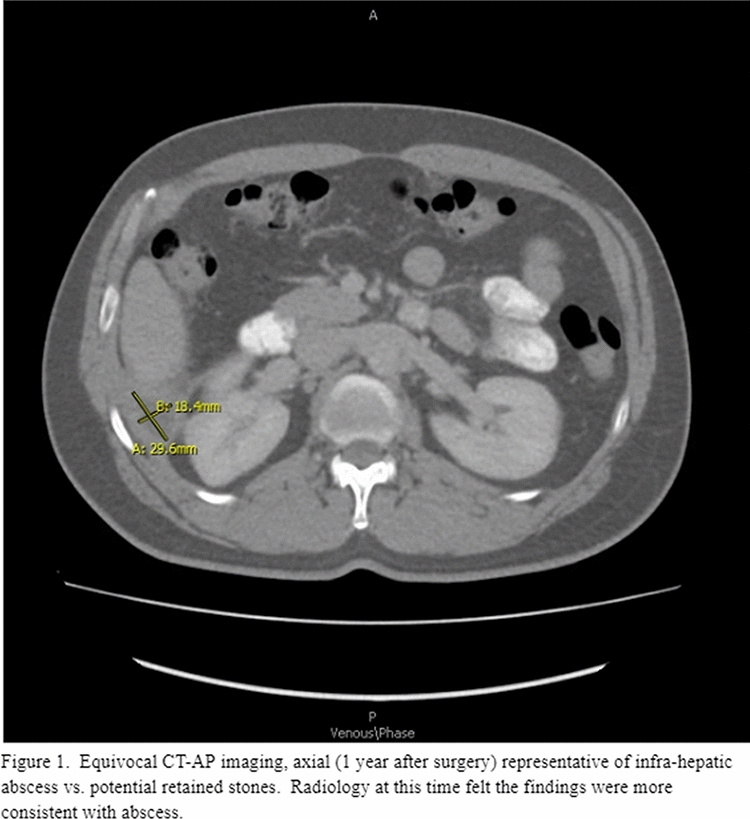 graphic file with name 464_2023_10072_Figgv_HTML.jpg