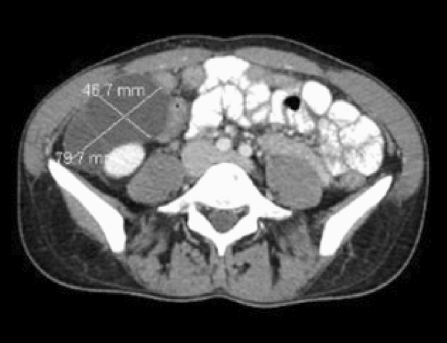 graphic file with name 464_2023_10072_Figfp_HTML.jpg