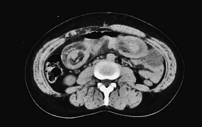 graphic file with name 464_2023_10072_Fign_HTML.jpg