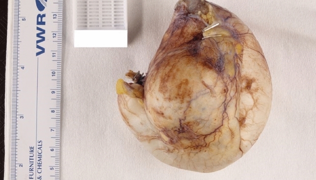 graphic file with name 464_2023_10072_Figfm_HTML.jpg