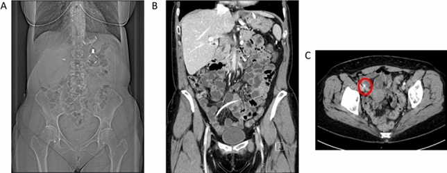 graphic file with name 464_2023_10072_Figav_HTML.jpg