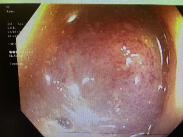 graphic file with name 464_2023_10072_Figci_HTML.jpg