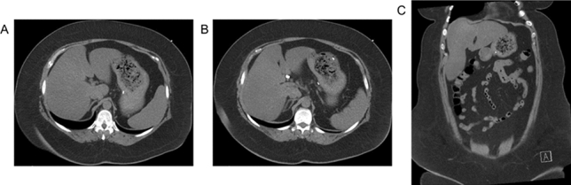 graphic file with name 464_2023_10072_Figax_HTML.jpg