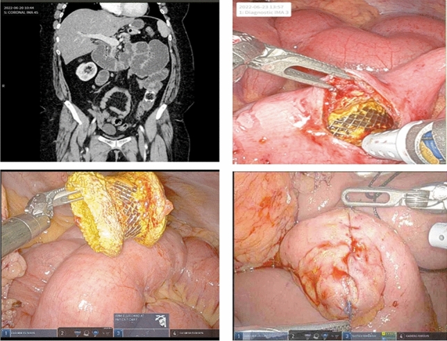 graphic file with name 464_2023_10072_Fighb_HTML.jpg