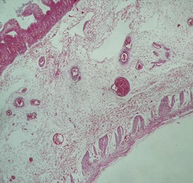 graphic file with name 464_2023_10072_Figr_HTML.jpg