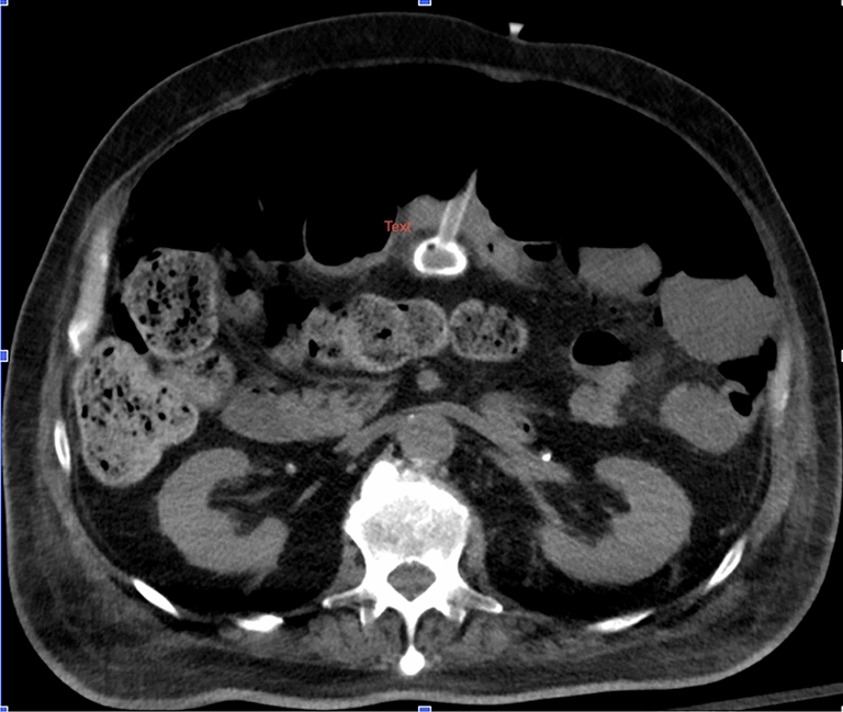 graphic file with name 464_2023_10072_Figk_HTML.jpg