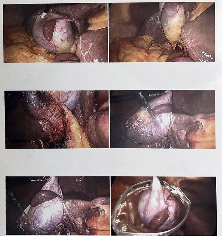 graphic file with name 464_2023_10072_Figbl_HTML.jpg