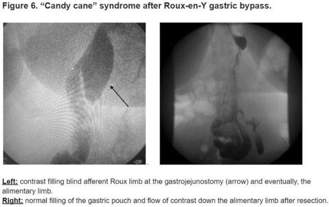 graphic file with name 464_2023_10072_Figap_HTML.jpg