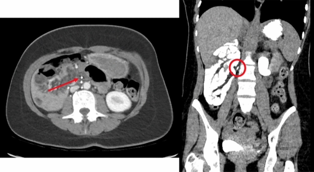 graphic file with name 464_2023_10072_Figab_HTML.jpg