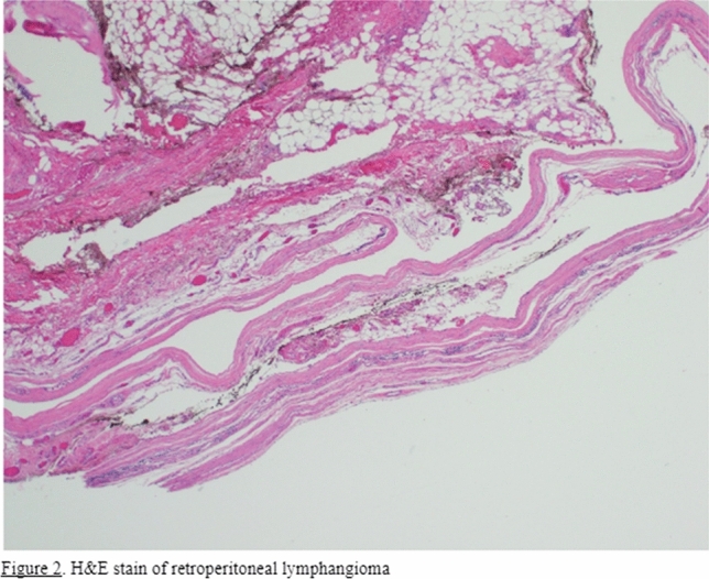 graphic file with name 464_2023_10072_Figfa_HTML.jpg