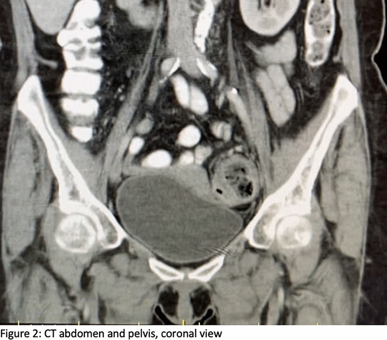 graphic file with name 464_2023_10072_Figcm_HTML.jpg