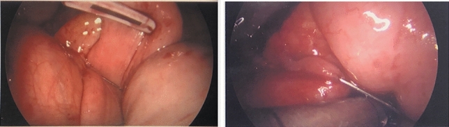 graphic file with name 464_2023_10072_Figac_HTML.jpg