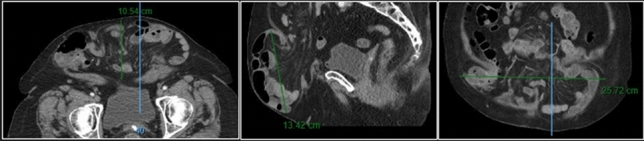 graphic file with name 464_2023_10072_Figa_HTML.jpg