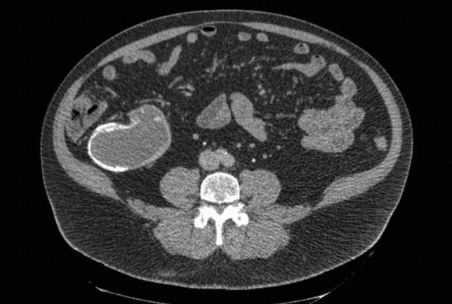 graphic file with name 464_2023_10072_Figgn_HTML.jpg