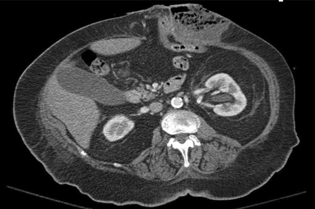 graphic file with name 464_2023_10072_Figdo_HTML.jpg