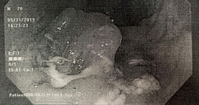 graphic file with name 464_2023_10072_Figby_HTML.jpg