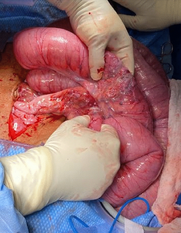 graphic file with name 464_2023_10072_Figfe_HTML.jpg