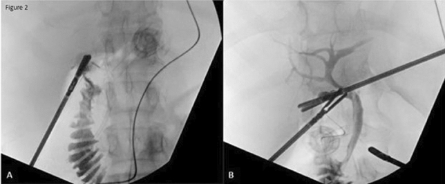 graphic file with name 464_2023_10072_Figaf_HTML.jpg