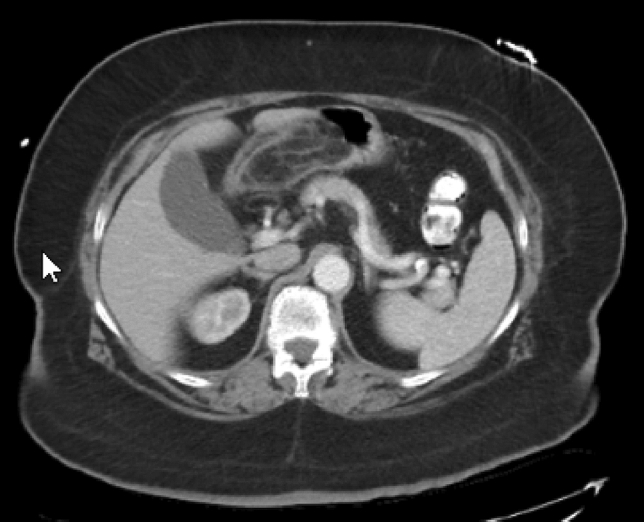 graphic file with name 464_2023_10072_Figef_HTML.jpg