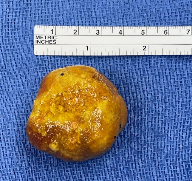 graphic file with name 464_2023_10072_Figau_HTML.jpg