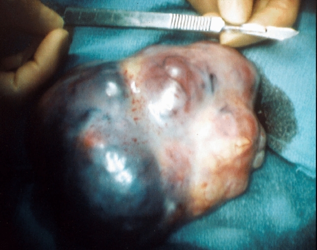 graphic file with name 464_2023_10072_Figfi_HTML.jpg