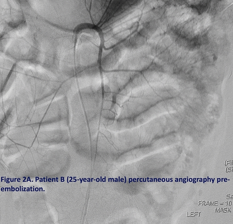 graphic file with name 464_2023_10072_Figex_HTML.jpg