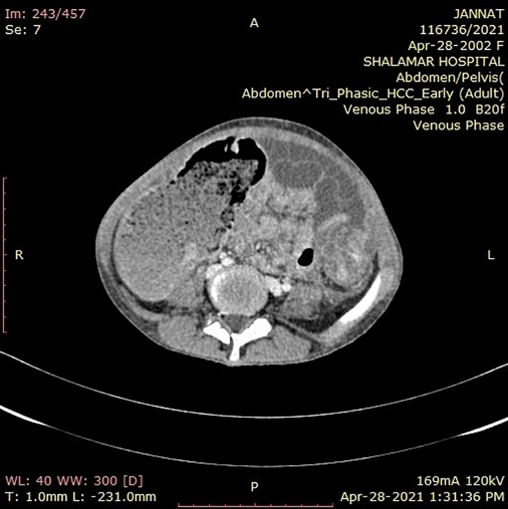 graphic file with name 464_2023_10072_Figcd_HTML.jpg