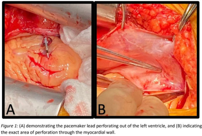 graphic file with name 464_2023_10072_Figz_HTML.jpg