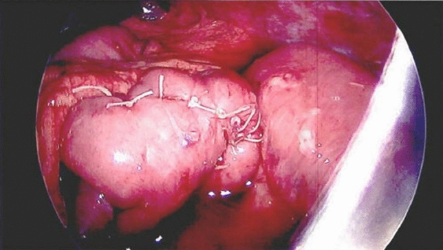 graphic file with name 464_2023_10072_Figfl_HTML.jpg