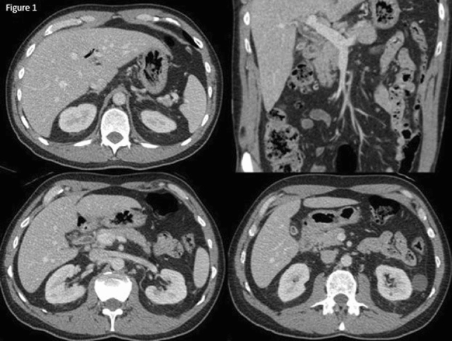 graphic file with name 464_2023_10072_Figae_HTML.jpg