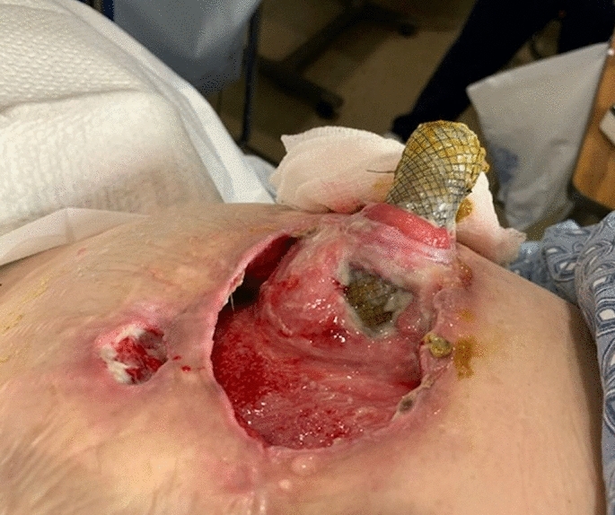 graphic file with name 464_2023_10072_Figds_HTML.jpg