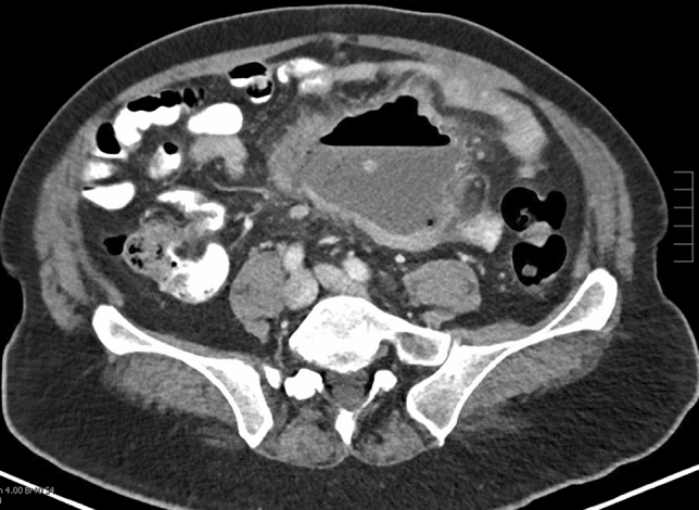 graphic file with name 464_2023_10072_Figai_HTML.jpg