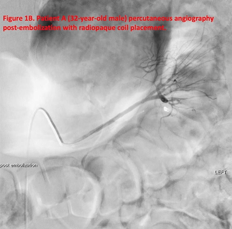 graphic file with name 464_2023_10072_Figew_HTML.jpg