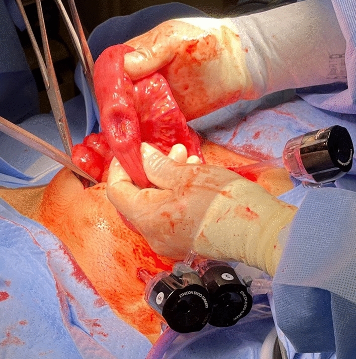 graphic file with name 464_2023_10072_Figx_HTML.jpg