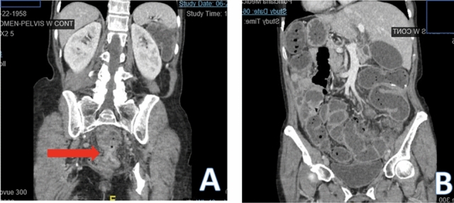 graphic file with name 464_2023_10072_Figcg_HTML.jpg