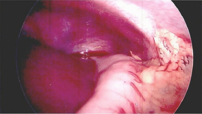 graphic file with name 464_2023_10072_Figfj_HTML.jpg