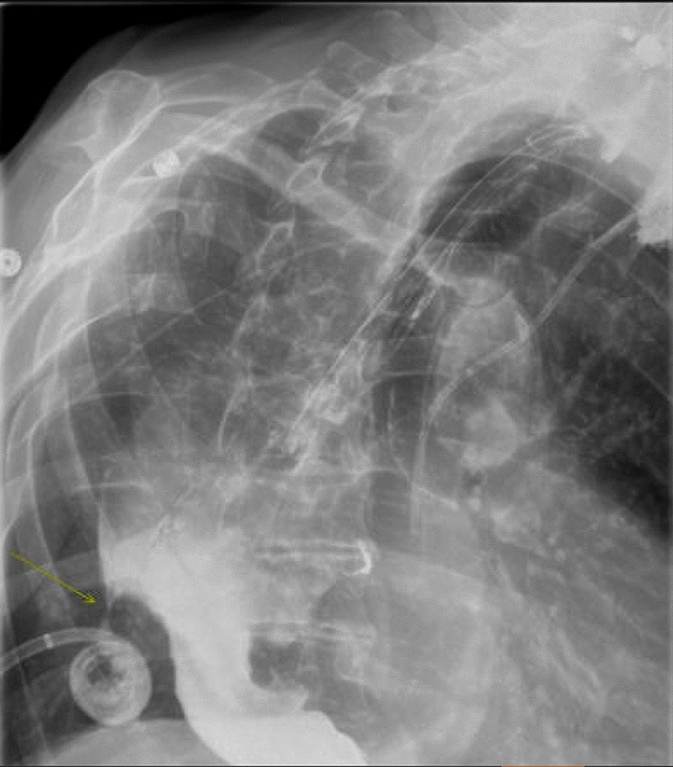 graphic file with name 464_2023_10072_Figec_HTML.jpg