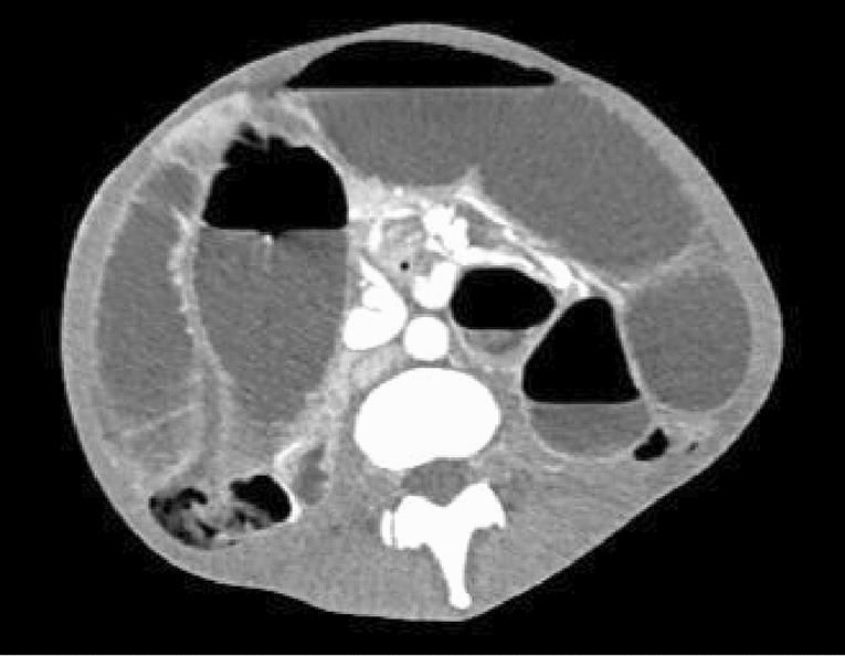 graphic file with name 464_2023_10072_Figfd_HTML.jpg