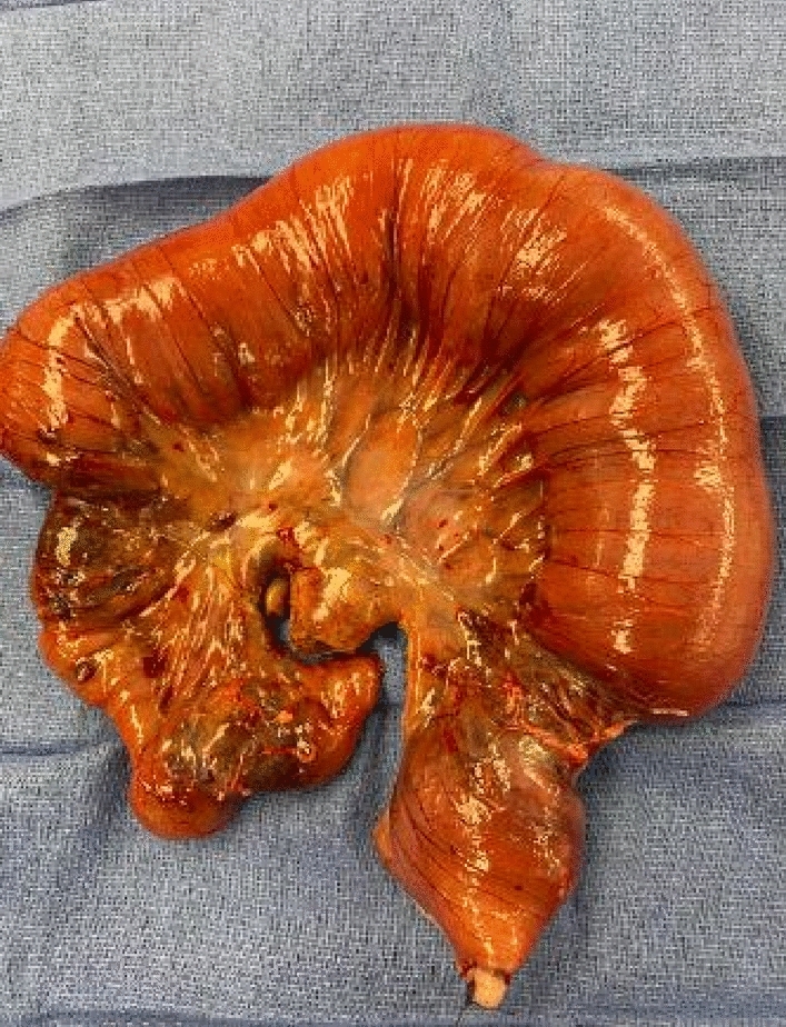 graphic file with name 464_2023_10072_Figff_HTML.jpg