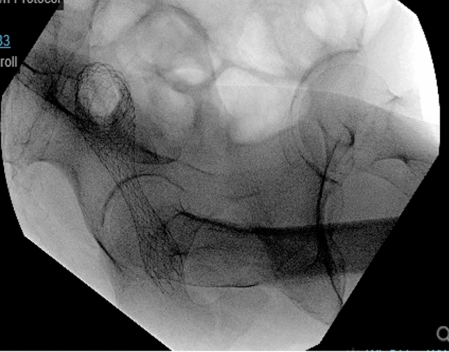 graphic file with name 464_2023_10072_Figck_HTML.jpg