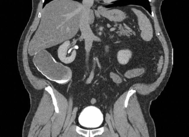 graphic file with name 464_2023_10072_Figgo_HTML.jpg