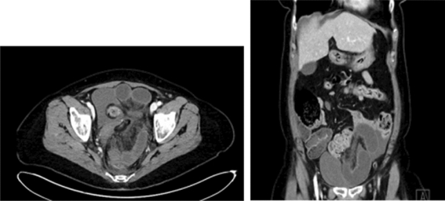 graphic file with name 464_2023_10072_Figaa_HTML.jpg