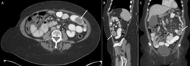 graphic file with name 464_2023_10072_Figat_HTML.jpg